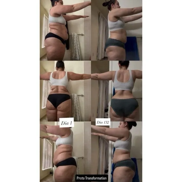 Antes y después de una clienta en cuatro ángulos