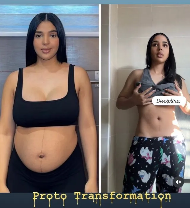 Antes y después de una clienta con top negro