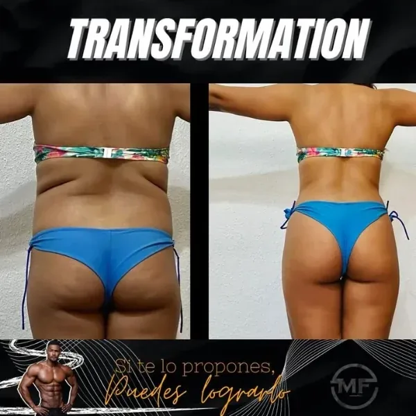 Antes y después de una clienta, cintura y espalda