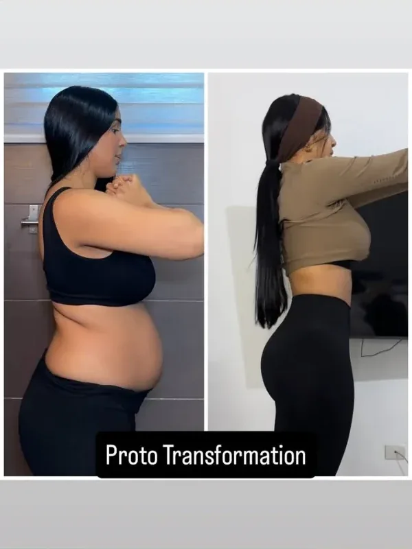 Antes y después de una clienta tres meses después del parto