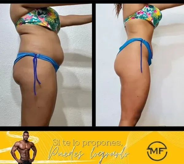 Antes y después de una clienta del coaching de Marcos Feliz