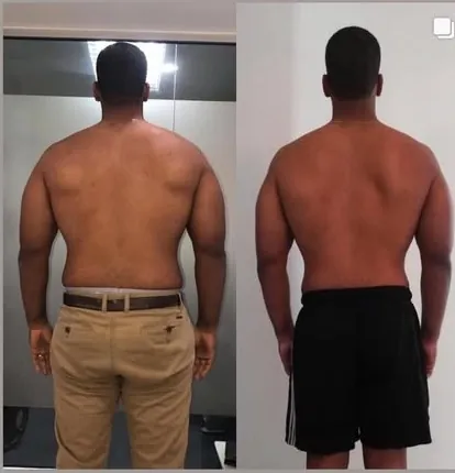 Antes y después de espalda de un cliente